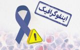 اینفوگرافیک/ سرطان، سومین عامل مرگ ایرانیان اینفوگرافیک/ سرطان، سومین عامل مرگ ایرانیان