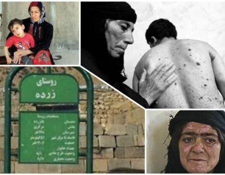 نفس‌های مسموم در هیروشیمای ایران؛ زرده در انتظار التیام زخم‌های کهنه
